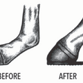 Foal Heel Extension